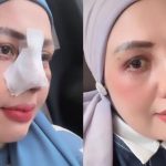 Usai Oplas, Elly Sugigi Tampil Beda: Kini Hanya Mau Pria Ganteng!