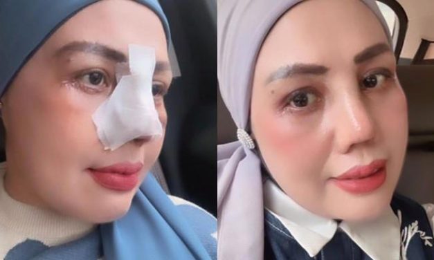 Usai Oplas, Elly Sugigi Tampil Beda: Kini Hanya Mau Pria Ganteng!