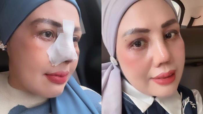 Usai Oplas, Elly Sugigi Tampil Beda: Kini Hanya Mau Pria Ganteng!